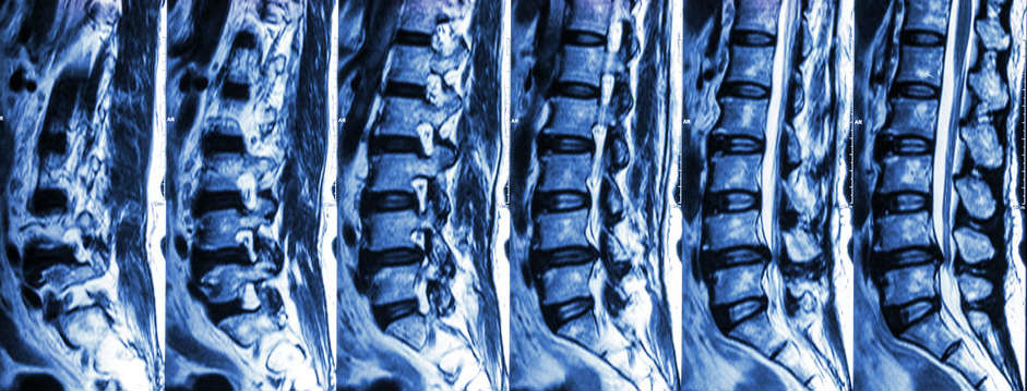 Save Time. Save Money. Get Peace of Mind: Skip the MRI